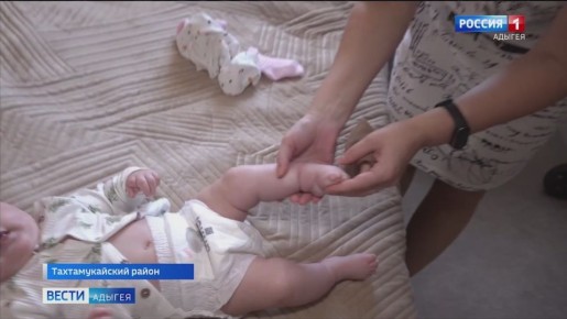 Четырехмесячной Еве из Тахтамукайского район срочно требуется хирургическое лечение