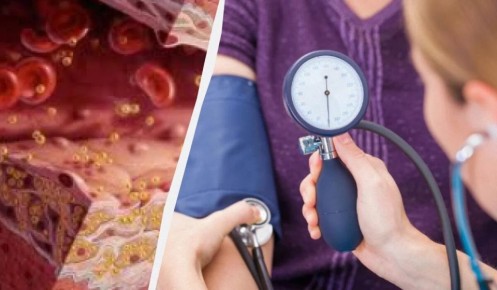 ���������� �������������: �������, ������� ����� ��������� �� ������� ��� �������� ��������