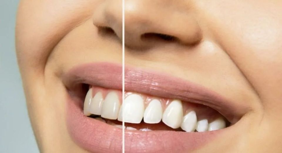 ����������� �����: �������� ���� ������ � ������� ����������������� �������