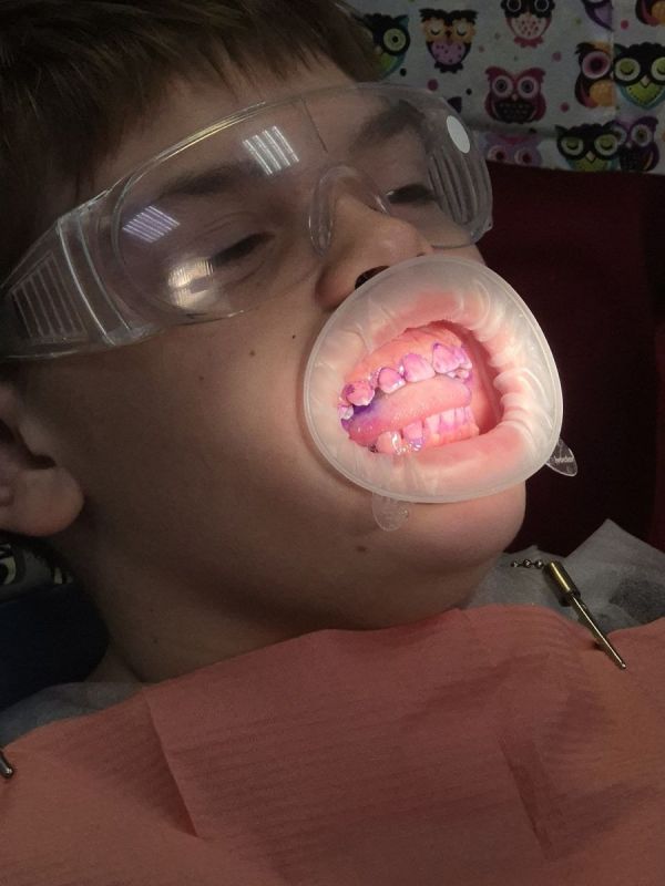 ������� �������� ������� �����