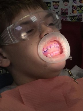 ������� �������� ������� �����