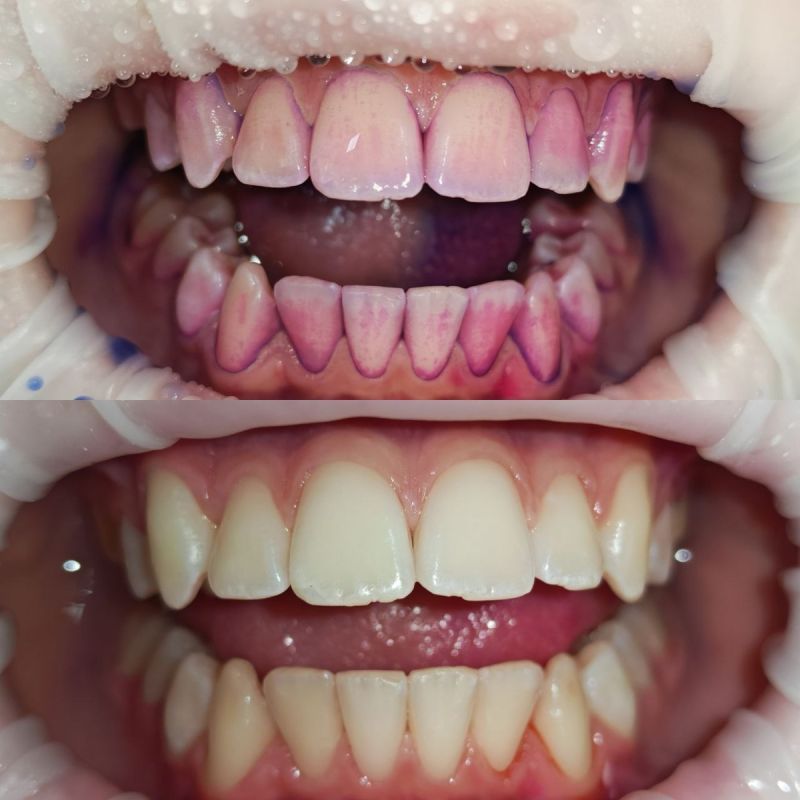 ��� ���������������� ����������� ������� ������ �������� � ������ � �����